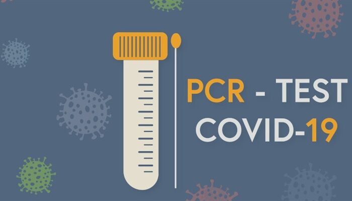 Böhm: Umsetzung der Pooltests ab März erfolgt viel zu spät