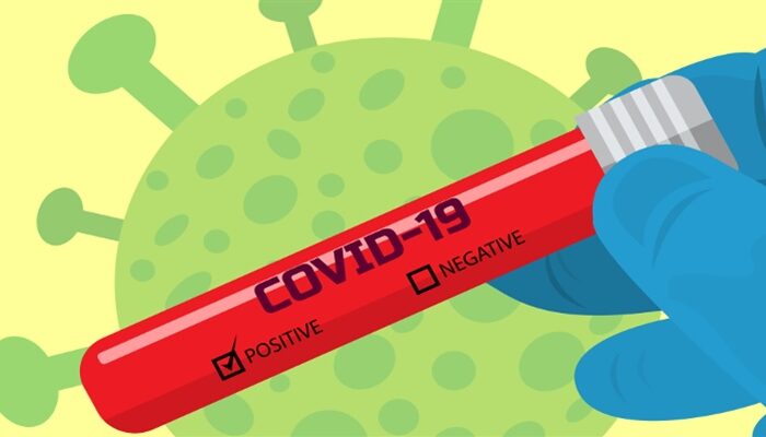 brlv zu Covid-19-Schnelltests bei Lehrkräften